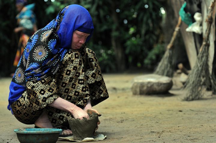 Охота на альбиносов в Танзании (10 фото)