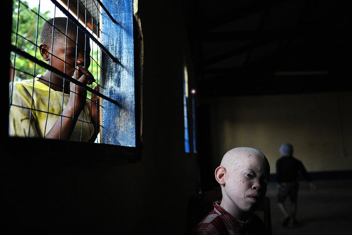 Охота на альбиносов в Танзании (10 фото)